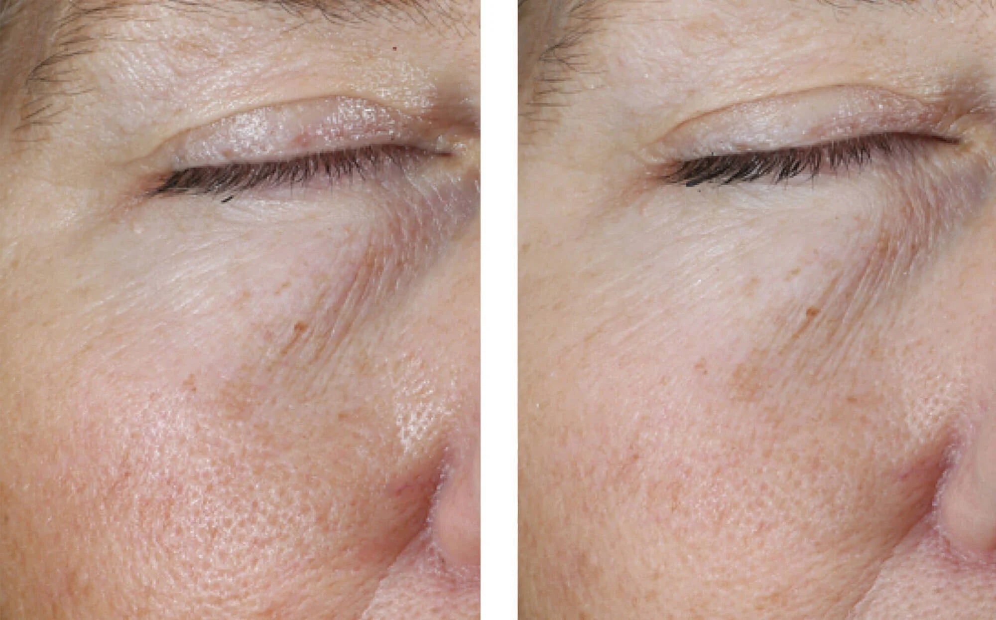 Instant Effect Gel Eye