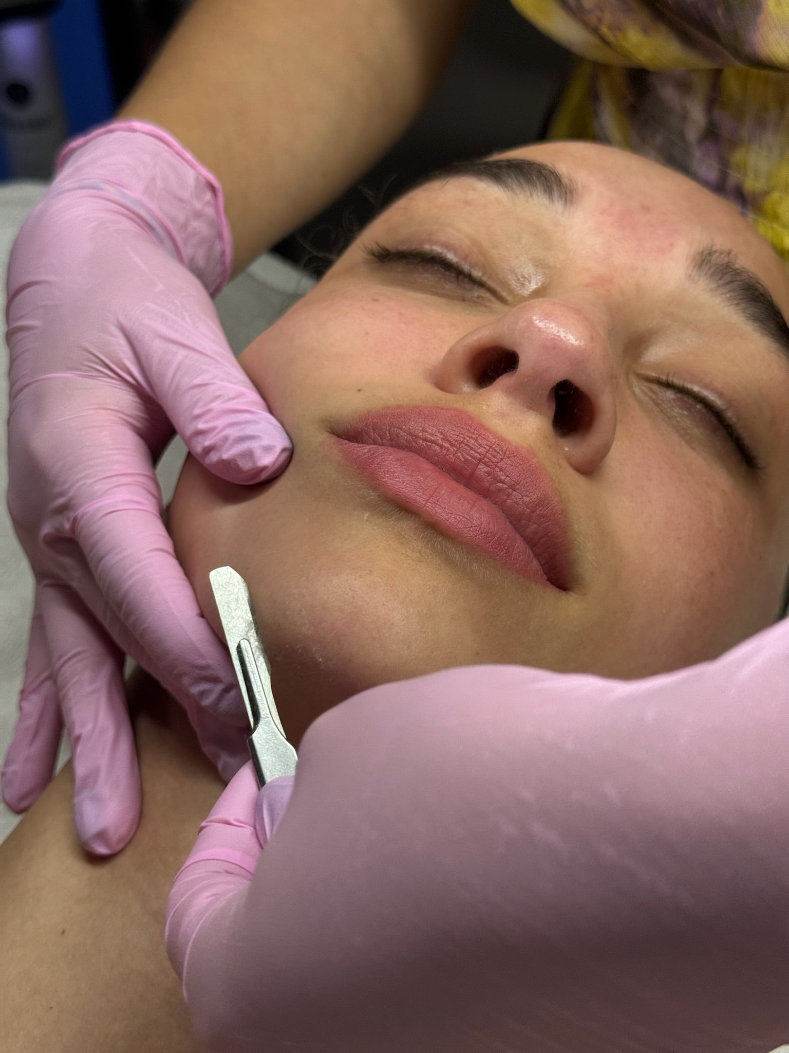 Person receiving a facial treatment with gloved hands