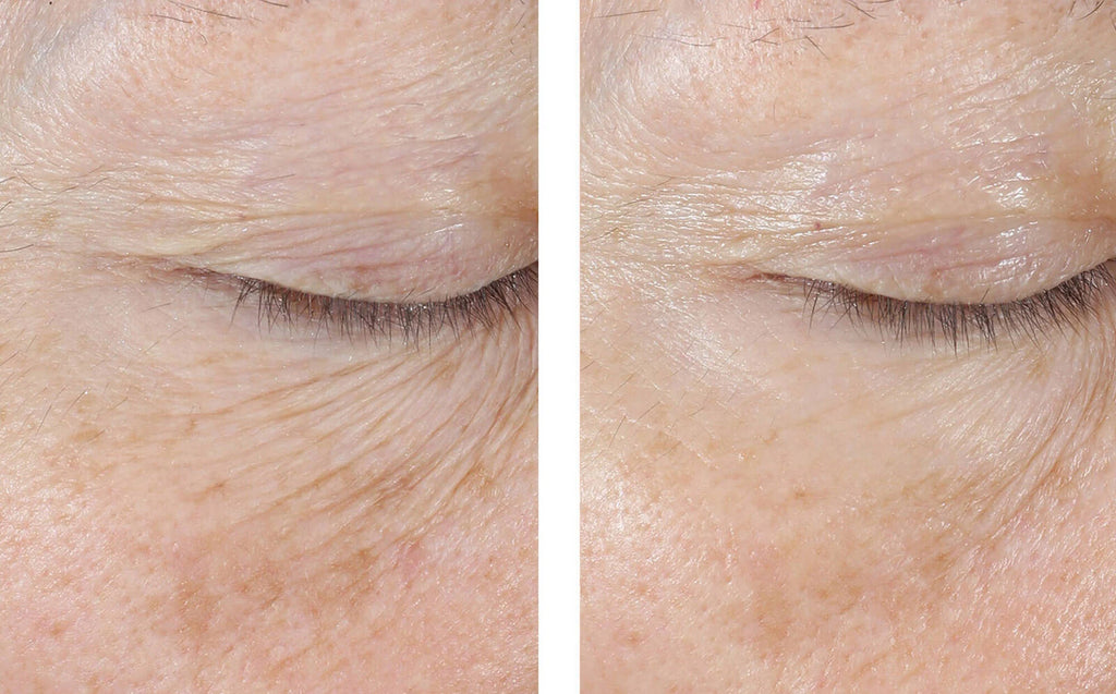 InterFuse Treatment Cream EYE