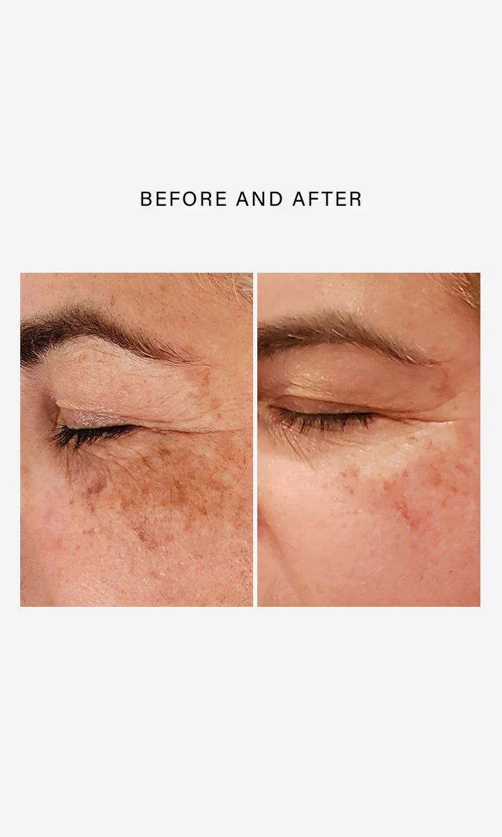 Triple Repair Complex