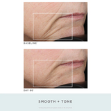 NUFACE TRINITY + WRINKLE REDUCER - Call to Order